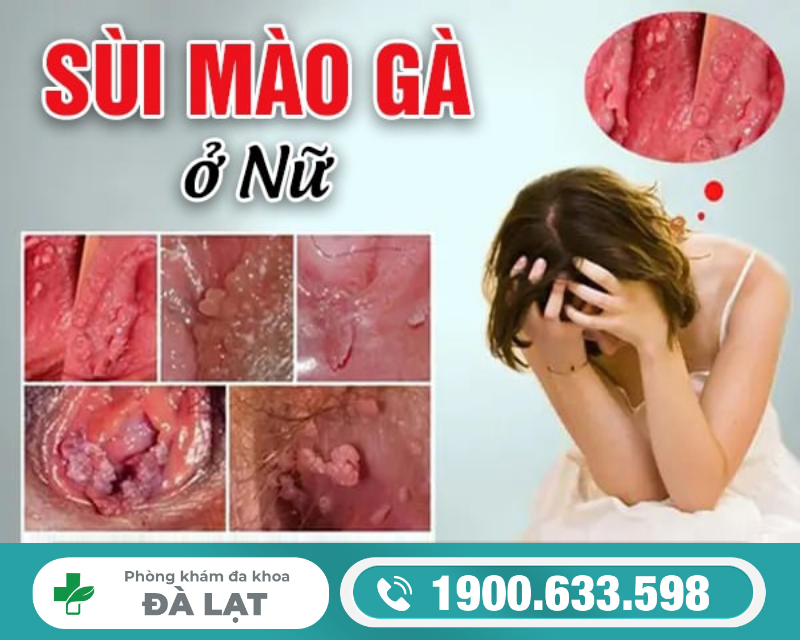 Hình ảnh minh họa